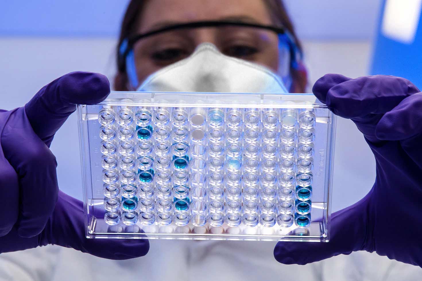 microbiology lab consumables